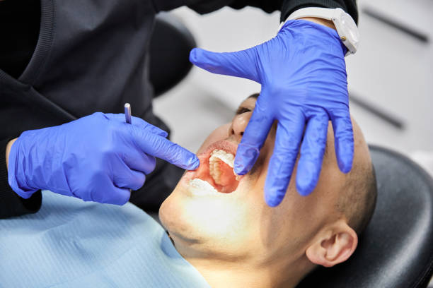 Best Knocked-Out Tooth Emergency  in Merrill, WI